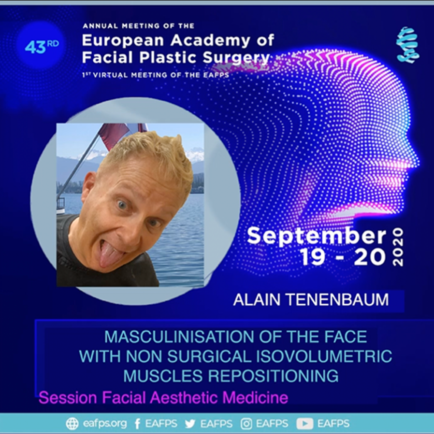 masculinisation of the face using endopeel
