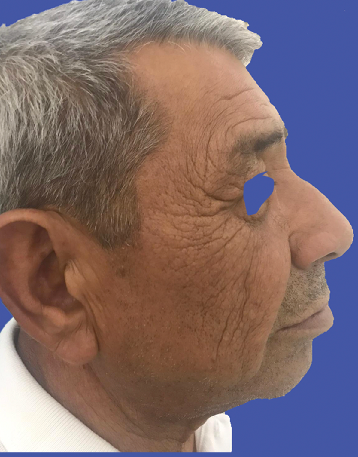 wrinkled face on aged man